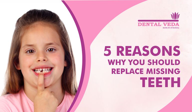 Reasons Why you should Replace Missing Teeth