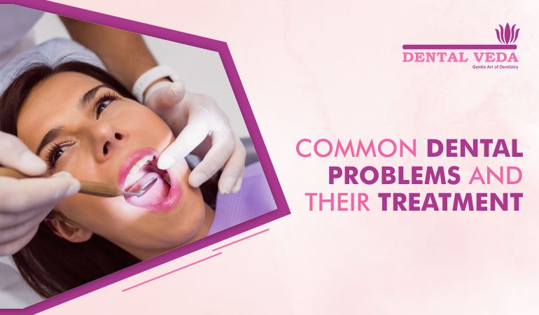 Common Dental Problems and their Treatment