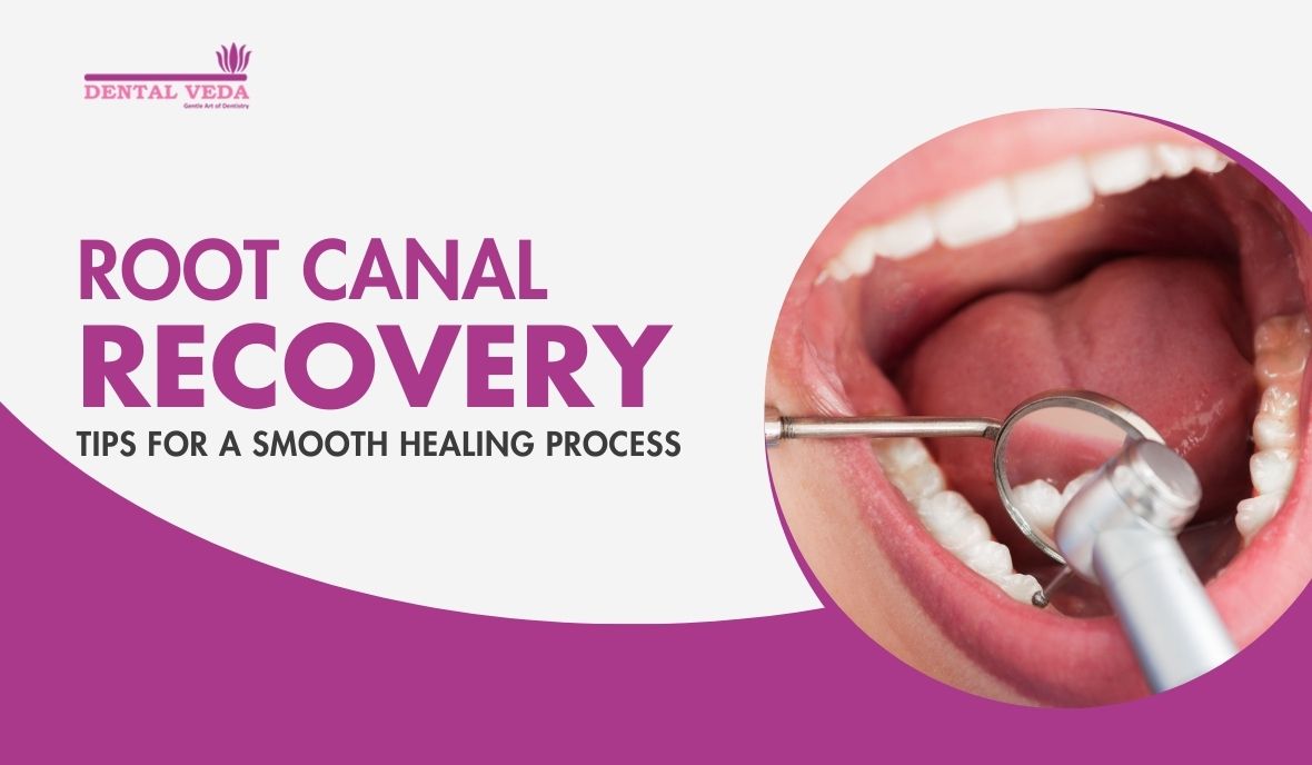 Root Canal Treatment