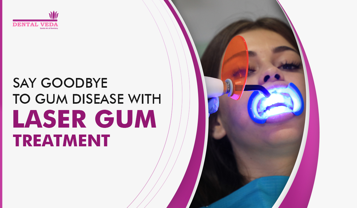 Laser Gum Treatment