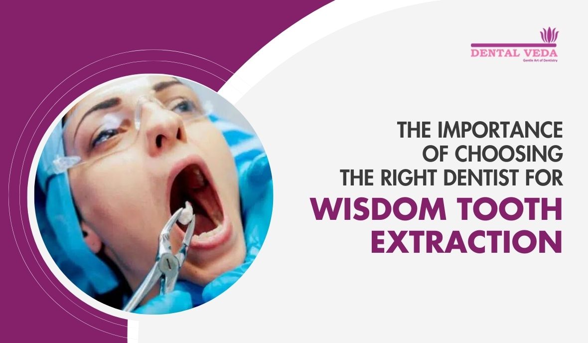 wisdom tooth extraction in Sushant Lok