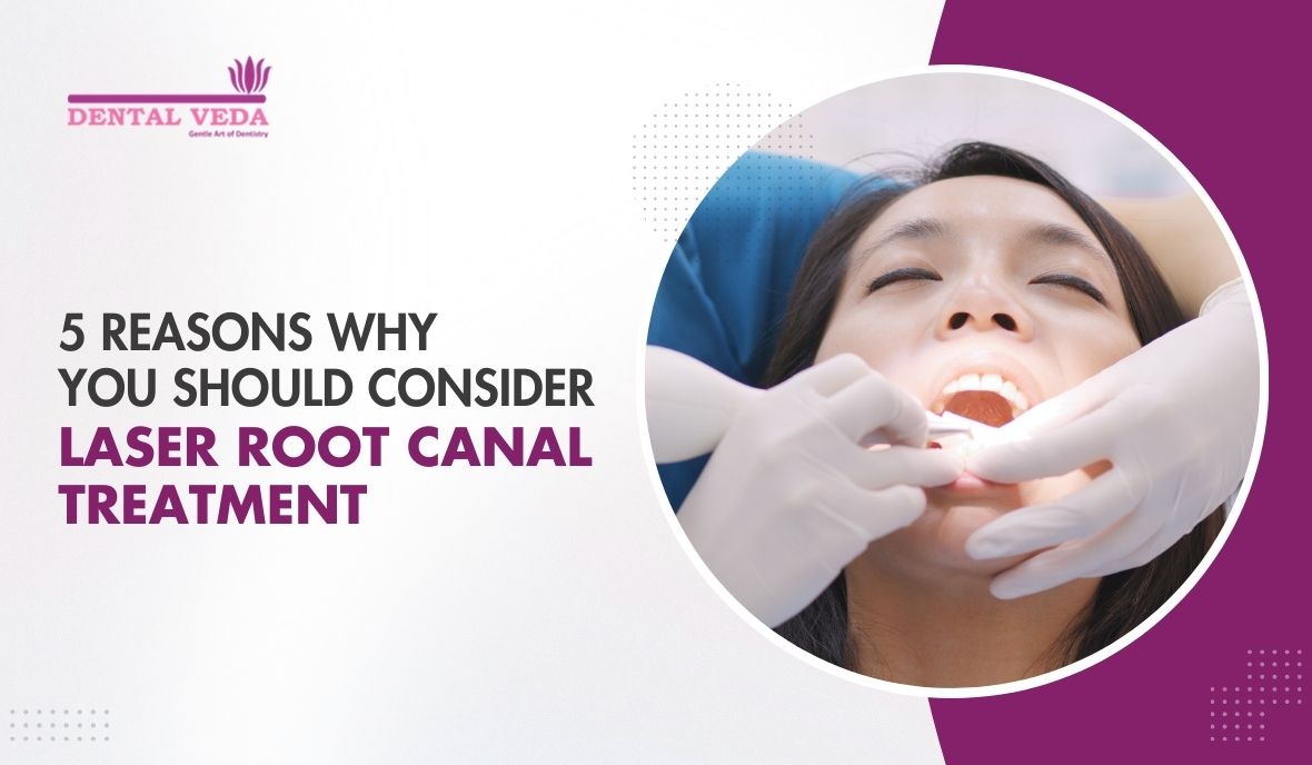 laser root canal treatment in Sushant Lok